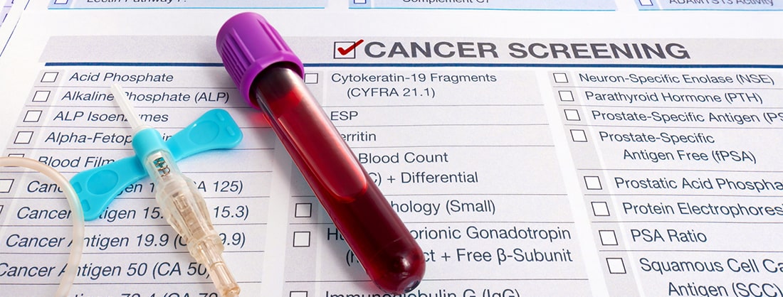Blood sample laboratory analysis circulating tumor DNA cancer cell detection medical research