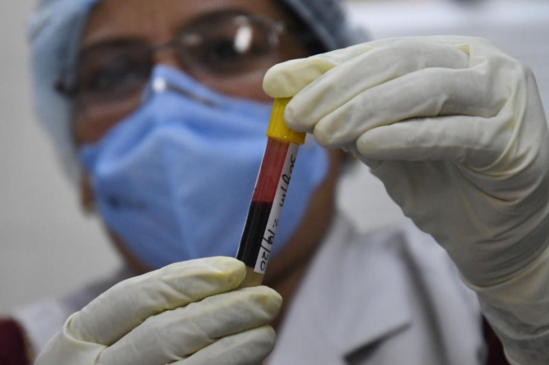 Galleri blood test cancer detection medical laboratory analysis circulating tumor DNA screening